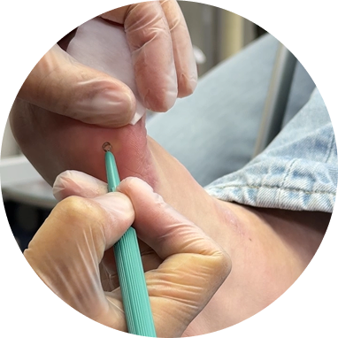 フットケアをする様子